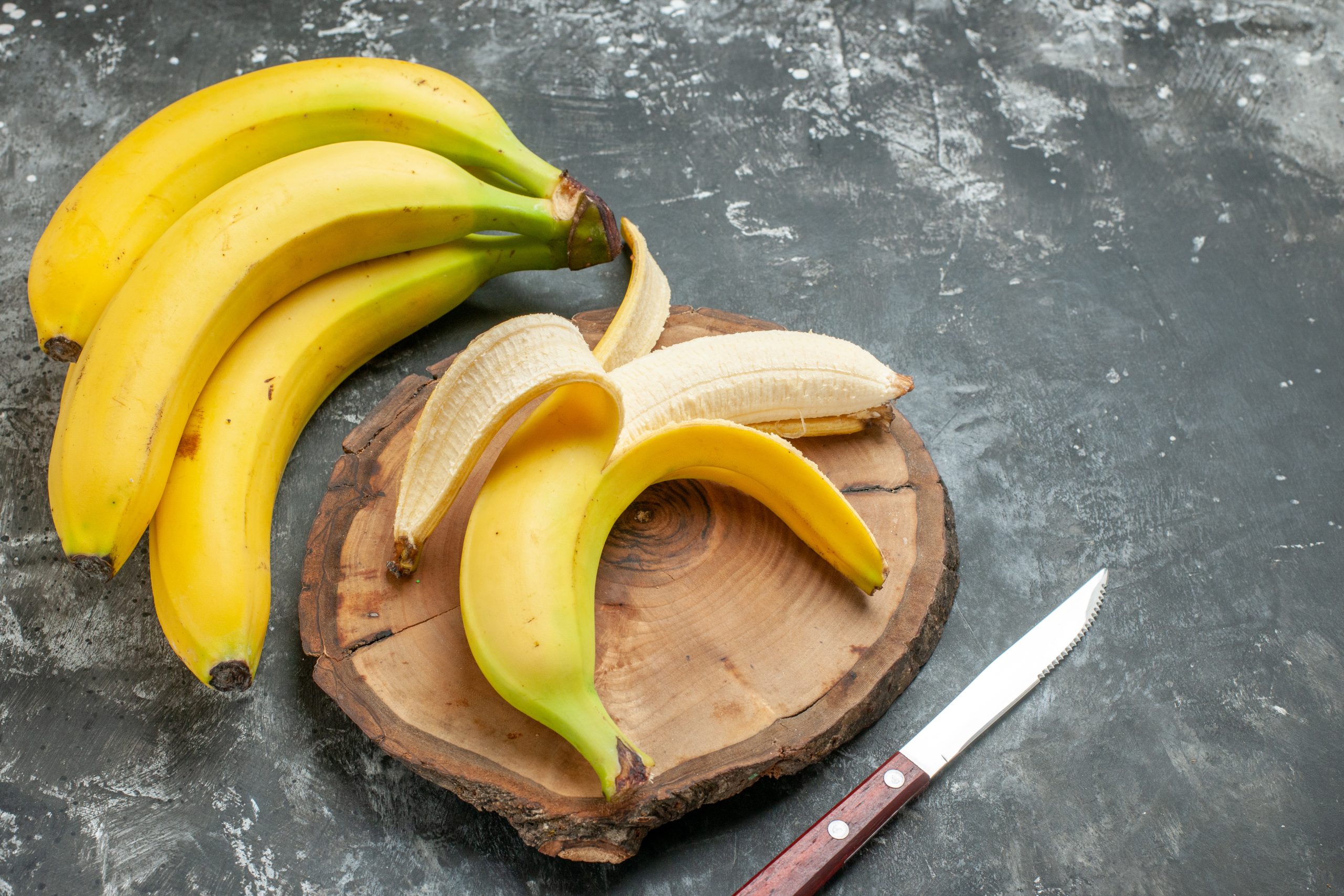 Bananas - Saiba por que você deve comer banana e quando moderar | Viver ...